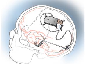 neuralink主要从事什么开发